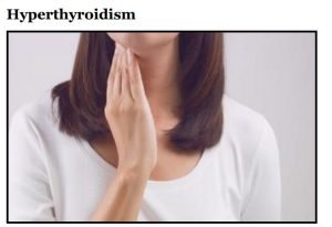 HYPOTHYRODISM