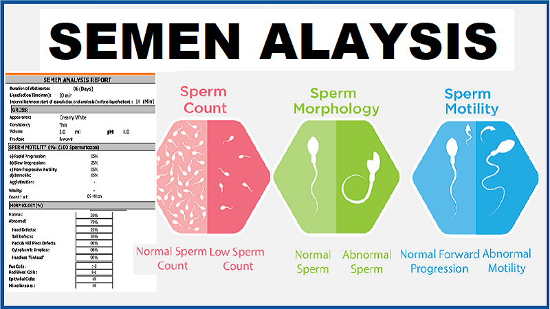 Read A Sperm Analysis Report