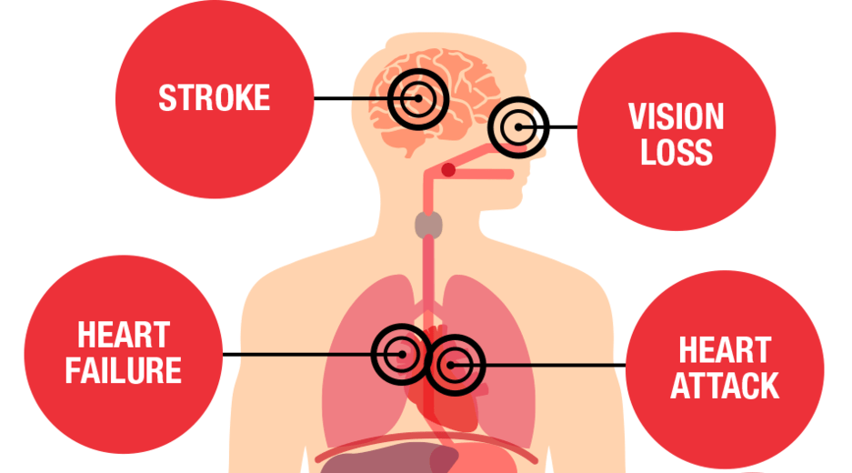 Vital signs: Body Temperature, Pulse, Respiratory rate (TPR) and Blood pressure