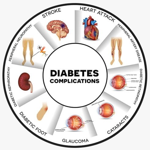 Optimal Health - diabetes complications - Optimal Health - Health Is True Wealth.