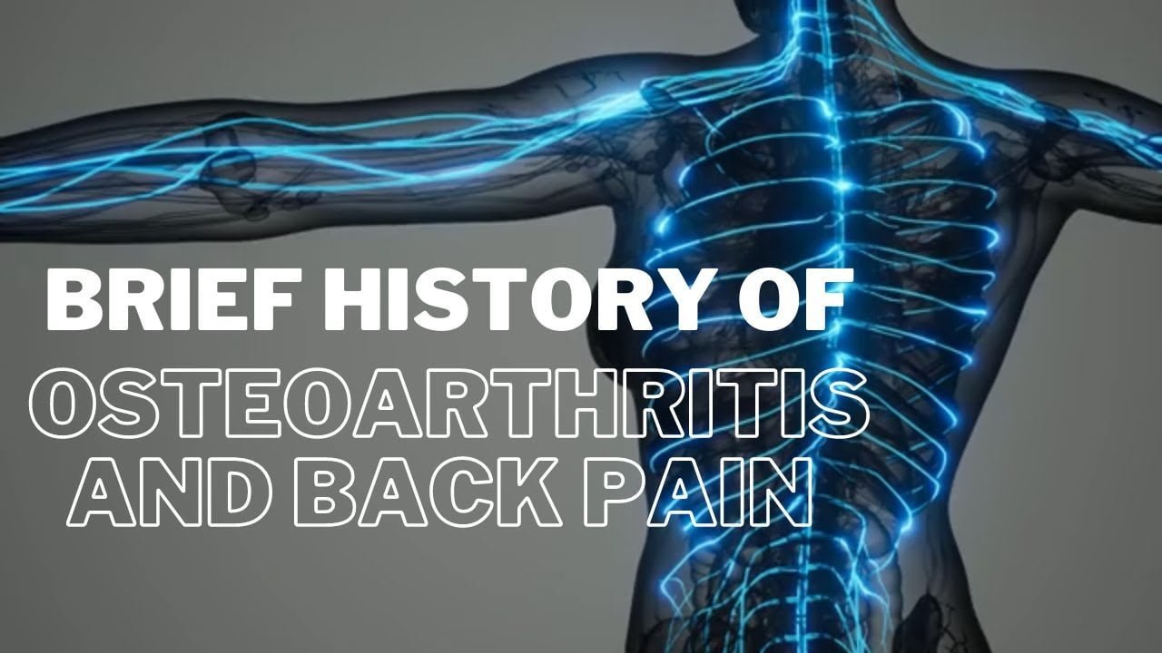 Brief History of Osteoarthritis and Back Pain 