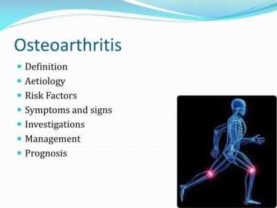 osteoarthritis l