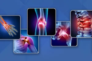 Overview of joint health: the value of joint health, 3 types of joints, and their purposes, exercise, painless vs. Healthy joints 